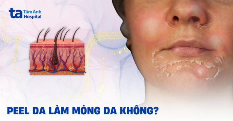 Lời khuyên từ chuyên gia về cách chọn phương pháp trị mụn đầu đen phù hợp với từng loại da